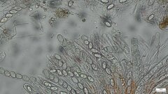 Scutellinia