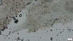 Pluteus