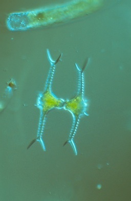 Staurastrum grallatorium