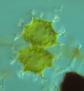 Xanthidium armatum cervicorne