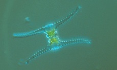 Staurastrum johnsonii