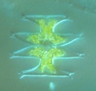 Micrasterias pinnatifida