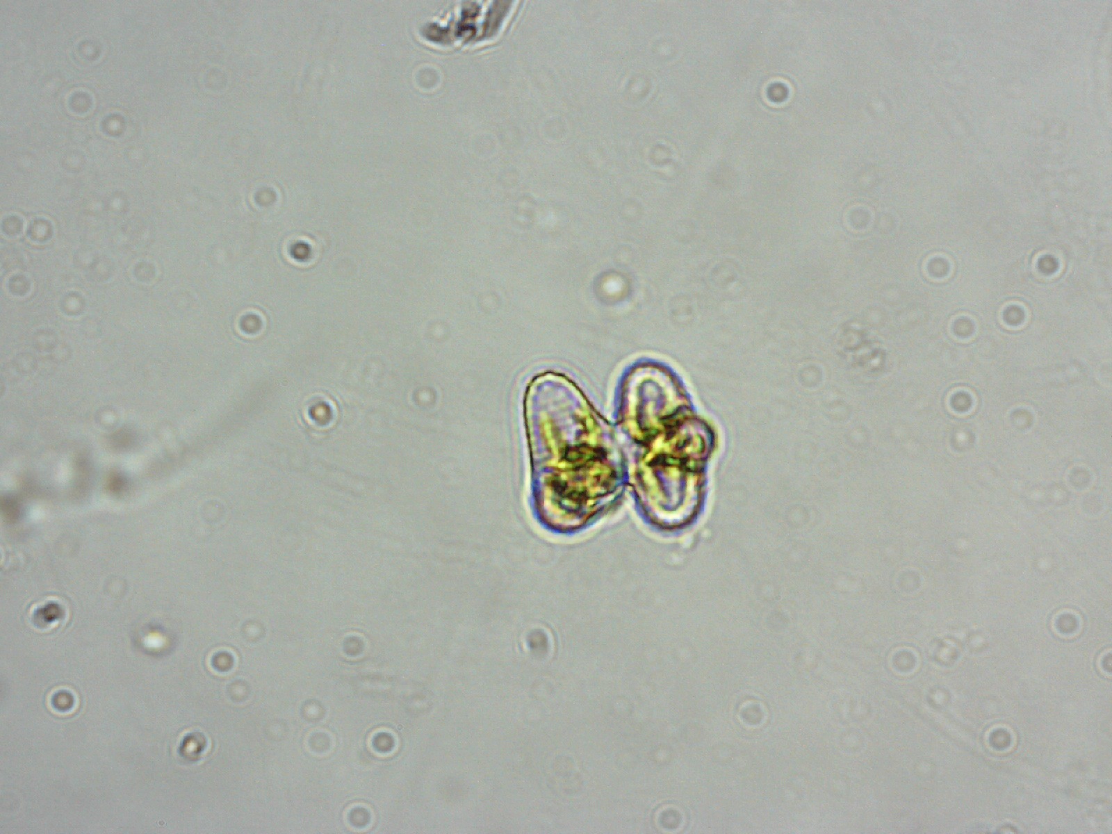 Staurastrum alternans