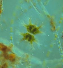 Staurastrum arctiscon