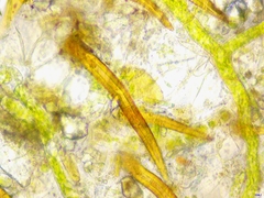 Scutellinia pseudotrechispora