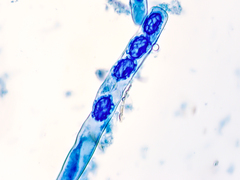 Scutellinia pseudotrechispora