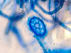 Scutellinia pseudotrechispora