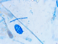 Scutellinia pseudotrechispora