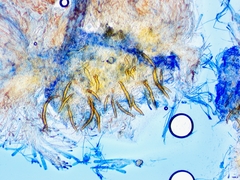 Scutellinia pseudotrechispora