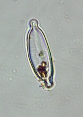 Encyonopsis microcephala