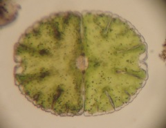 Micrasterias denticulata
