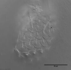 Chaetonotus acanthocephalus