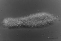 Chaetonotus acanthocephalus