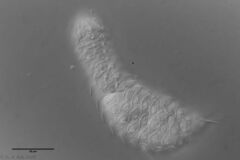 Chaetonotus acanthocephalus