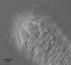 Chaetonotus acanthocephalus