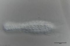 Chaetonotus acanthocephalus
