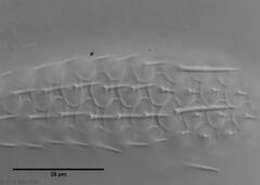 Chaetonotus acanthocephalus