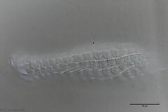 Chaetonotus acanthocephalus