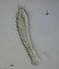 Chaetonotus arquatus