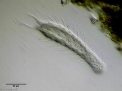 Chaetonotus arquatus
