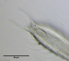 Chaetonotus arquatus