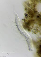 Chaetonotus arquatus
