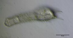 Chaetonotus arquatus