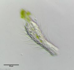 Chaetonotus arquatus