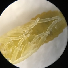 Ceratulus spectabilis