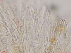 Hymenoscyphus menthae