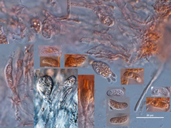 Pseudostypella nothofagi