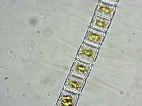 Hyalotheca mucosa
