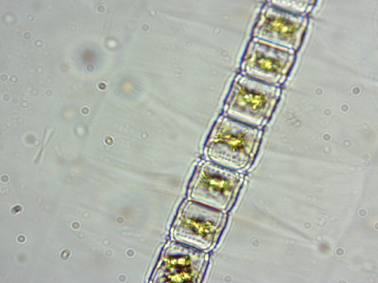 Hyalotheca mucosa