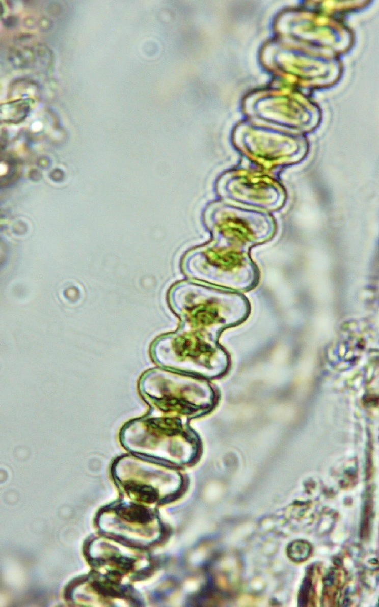 Spondylosium