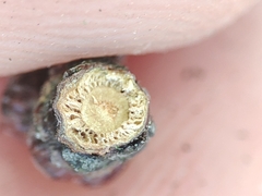 Acalitus phloeocoptes