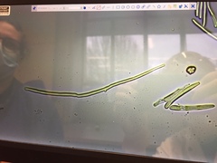 Mycogloea macrospora