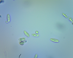 Bresadolia craterella