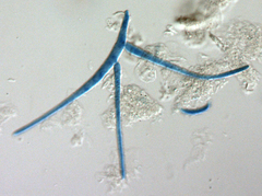 Tricladium splendens