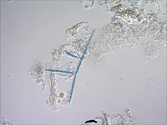 Tricladium angulatum