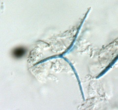 Alatospora acuminata