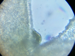 Kerona pediculus