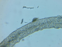 Kerona pediculus
