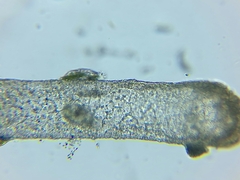 Kerona pediculus