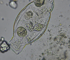 Tetrahymena