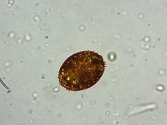 Trachelomonas superba