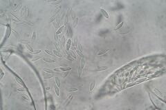 Ascozonus woolhopensis