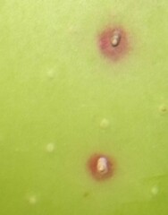 Diaspidiotus perniciosus