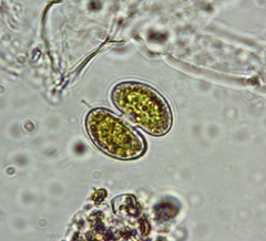 Cosmarium contractum