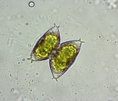 Staurastrum avicula
