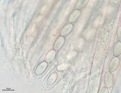 Peziza echinospora